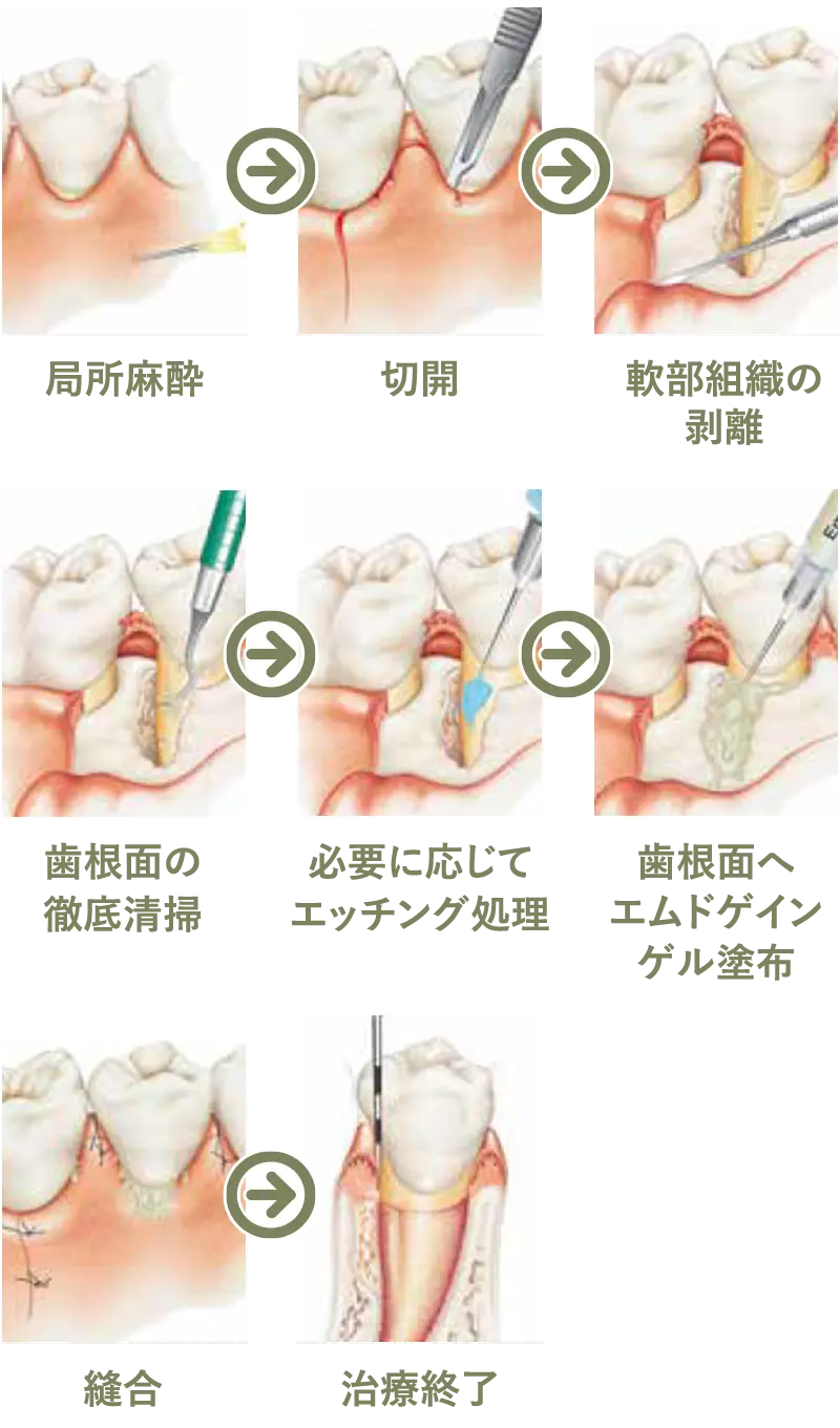 エムドゲイン
